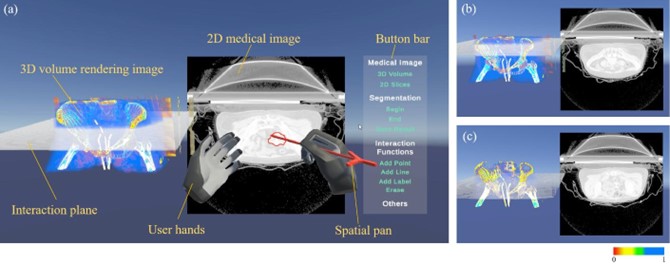 20230521-新葡萄官网AMG医学院博士生张楠、杨讷与李阳曦在中国生物医学工程大会暨创新医疗峰会上获奖-张楠-基于三维空间交互的宫颈癌靶区勾画虚拟现实环境总览.jpg